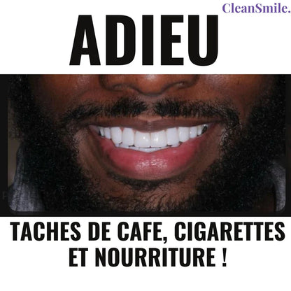 GlorySmile® - Sérum de blanchiment dentaire