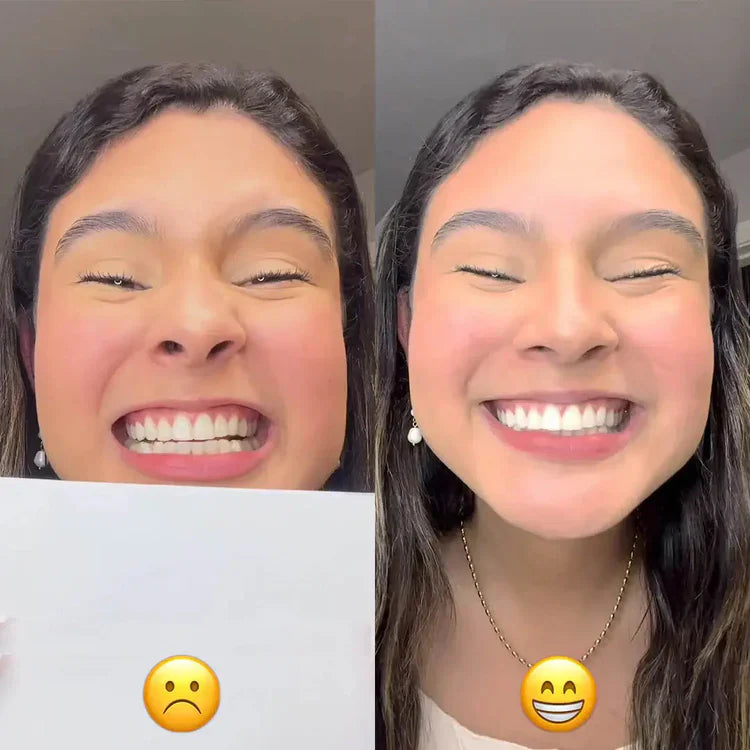 GlorySmile® - Sérum de blanchiment dentaire