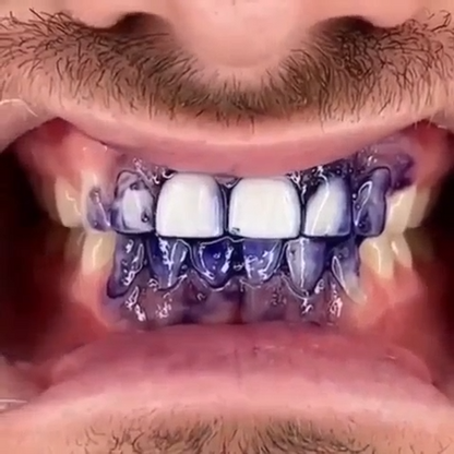 GlorySmile® - Sérum de blanchiment dentaire